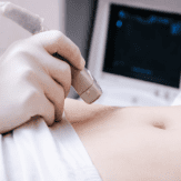 腹部超音波検査（腹部エコー）